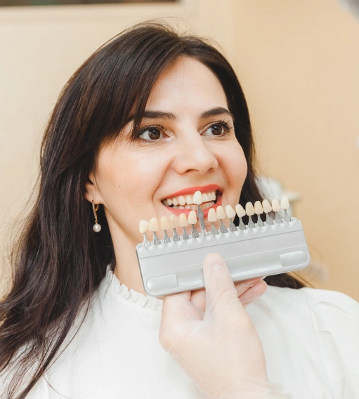 Veneers